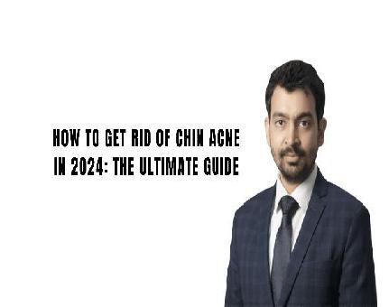 Best Dermatologist in Bangalore
