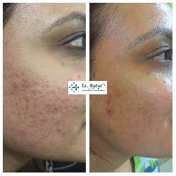 Top Dermatologist...