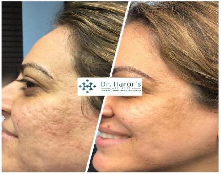 Delhi’s Leading Dermatologist for Skin Treatments