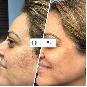 Delhi’s Leading Dermatologist for Skin...