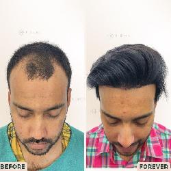 Best Leading Hair...