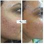 Best Skin Treatments Clinic in Greater Kailash