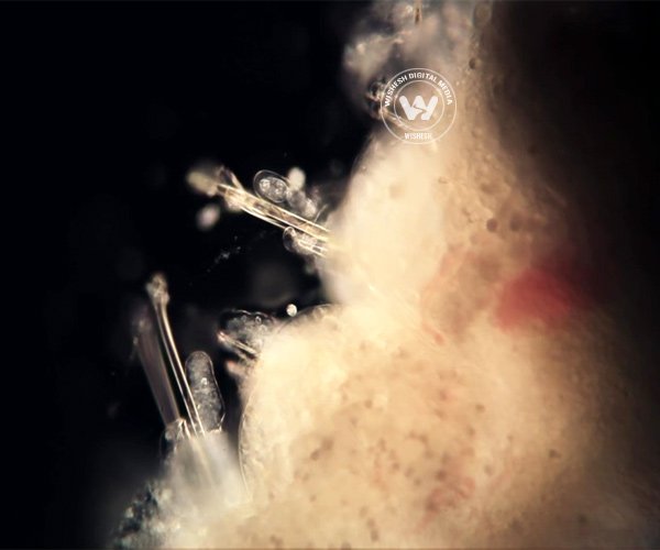 Can Lice Unravel the Secret ofHuman Evolution?