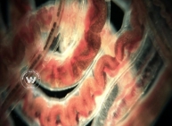 Can Lice Unravel the Secret ofHuman Evolution?