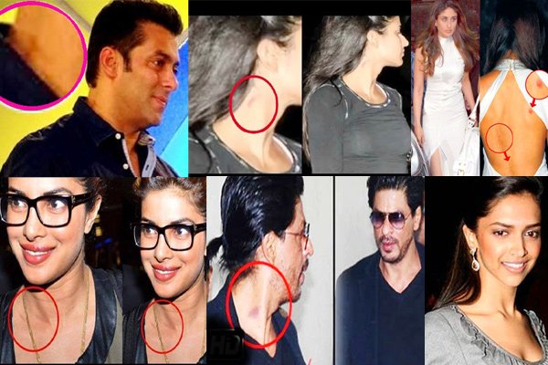 Bollywood celebs caught with love bites
