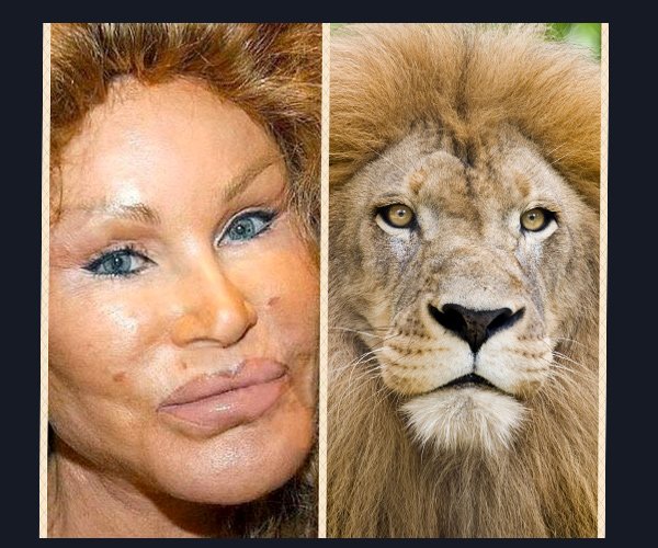Hollywood celebs with botched up plastic surgeries