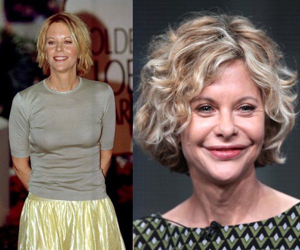 Hollywood celebs with botched up plastic surgeries