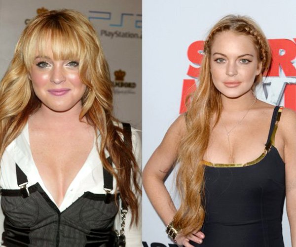 Hollywood celebs with botched up plastic surgeries