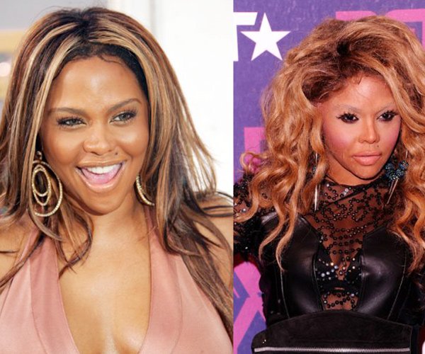 Hollywood celebs with botched up plastic surgeries