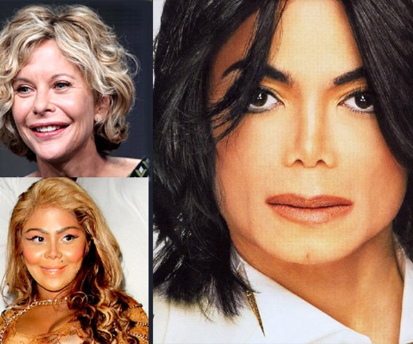 Hollywood celebs with botched up plastic surgeries