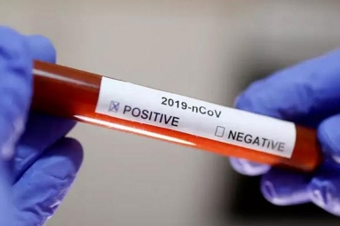 Hyderabad techie Tests Positive for COVID-19, quarantined in Gandhi Hospital