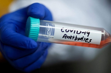 COVID-19 antibodies Present in Patients after 4 months of recovery: Study