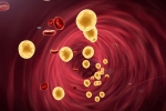 Cholesterol In Children, Cholesterol In Children news, what parents have to know about cholesterol in children, Teenagers Cholesterol In Children, Cholesterol In Children news, what parents have to know about cholesterol in children, Teenagers