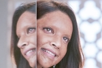 Deepika Padukone, Deepika Padukone next film, first look of deepika padukone as acid attack survivor, Padmaavat
