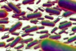 E.coli Outbreak United Kingdom, E.coli Outbreak new breaking, all about e coli outbreak in the united kingdom, Urinating