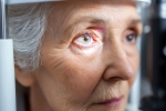 Glaucoma, Glaucoma health experts, all about the eye disease glaucoma, Steroids Glaucoma, Glaucoma health experts, all about the eye disease glaucoma, Steroids