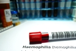 Hemophilia health tips, Hemophilia breaking, why are men likely to develop hemophilia, Doctors