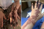 how long does black henna last, how long does black henna reaction last, henna tattoo cause aussie woman to almost lose her hand, Hair dye