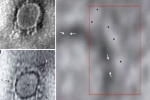 coronavirus, imaging, indian scientists reveal images of the novel coronavirus under a microscope, Indian scientists coronavirus, imaging, indian scientists reveal images of the novel coronavirus under a microscope, Indian scientists