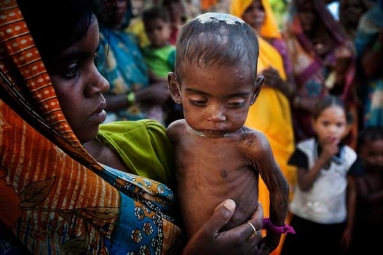 Malnutrition, Child Deaths Outbreak India's Tribal People