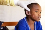 Monkeypox Outbreak news, Monkeypox Outbreak breaking, is monkeypox outbreak coming to india, Swine flu