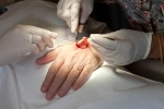 cancer pain relief and palliative care, pain free cancer treatment, cancer treatment can now be pain free, Measles