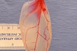 Using Spinach Leaves Patch For Diseased Hearts, Using Spinach Leaves Patch For Diseased Hearts, patch for diseased hearts using spinach leaves, Spinach leaves Using Spinach Leaves Patch For Diseased Hearts, Using Spinach Leaves Patch For Diseased Hearts, patch for diseased hearts using spinach leaves, Spinach leaves