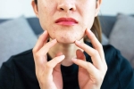 Stress Acne symptoms, Stress Acne news, does your regular routine cause you acne, Acne