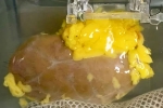 Universal Kidney latest update, Universal Kidney new updates, scientists develop universal kidney transplanted to any blood group, Organ transplant Universal Kidney latest update, Universal Kidney new updates, scientists develop universal kidney transplanted to any blood group, Organ transplant