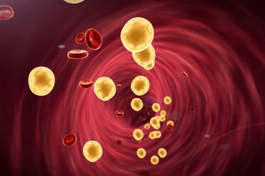 Tips to Lower Cholesterol when Statins don't Work
