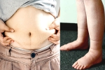 Water Retention, Water Retention food, some effective ways to reduce water retention, Heart diseases