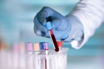 molecule, Pittsburg, researchers discover an antibody that can cure covid 19 what is it, Nasal spray molecule, Pittsburg, researchers discover an antibody that can cure covid 19 what is it, Nasal spray