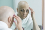 hair loss, hair loss in Chemotherapy, new cancer treatment prevents hair loss from chemotherapy, Manchester