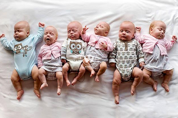 Curious Cases of Multiple Births in Pakistan},{Curious Cases of Multiple Births in Pakistan