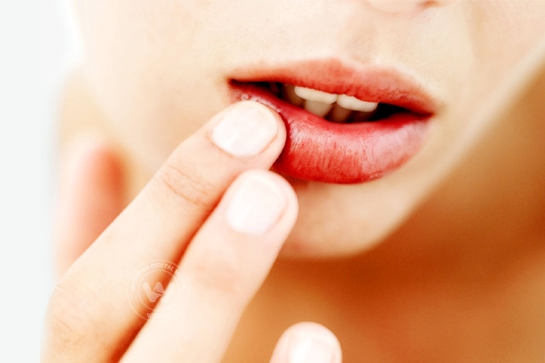Tips to lighten your lips},{Tips to lighten your lips