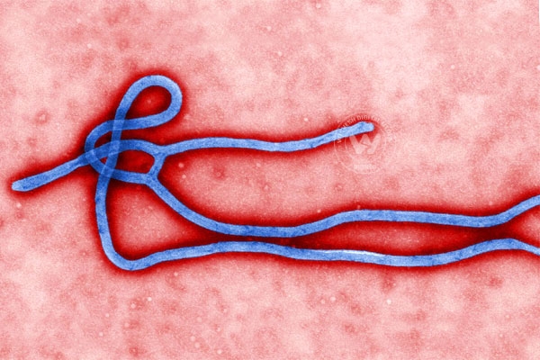 Is India ready to fight Ebola virus?},{Is India ready to fight Ebola virus?