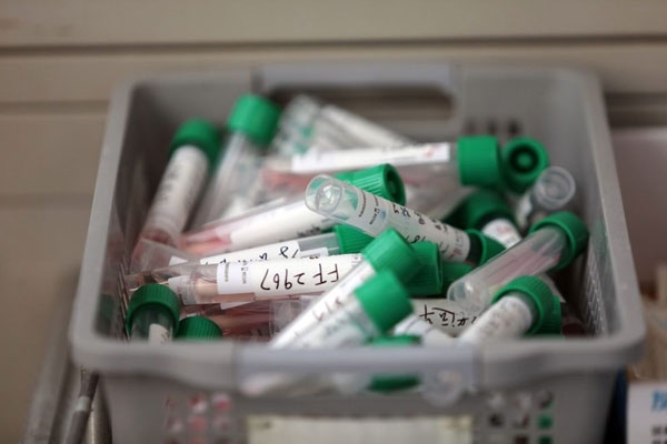 China initiates first trial of their coronavirus vaccine - Ad5-nCoV
