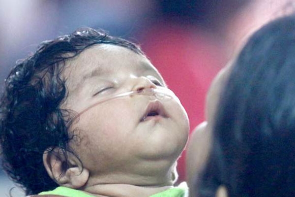 Gorakhpur Tragedy, Infants death takes a toll over 70